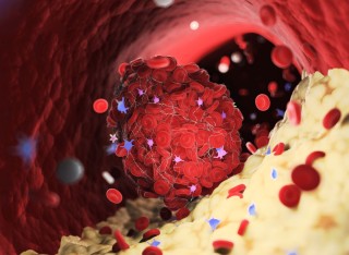 Illustration of cancer