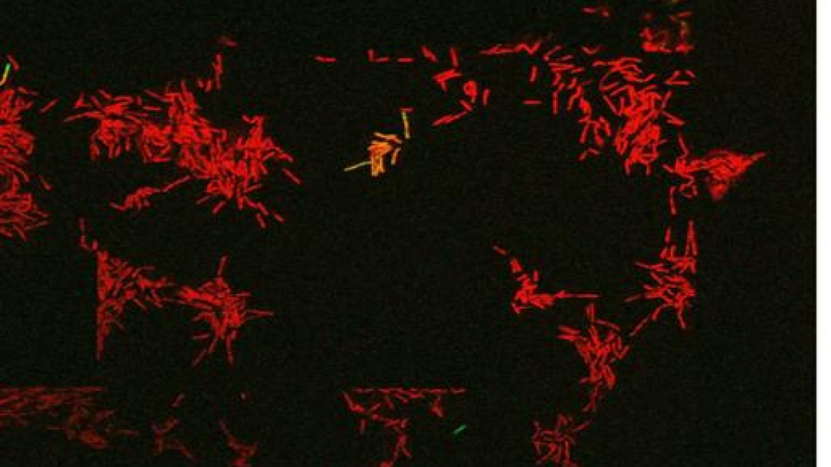 m smegmatis Thumbnail