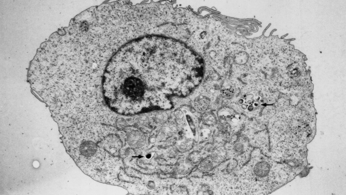 macrophagetbem Thumbnail