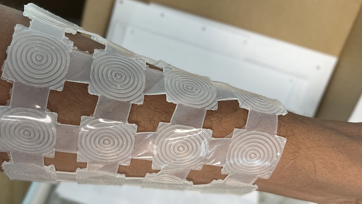 Initial prototype of STEPS1.0 technology worn on an arm